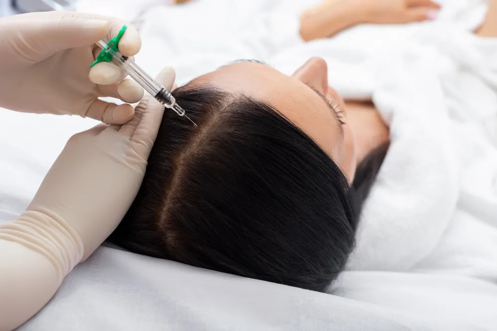 الميزوثيرابي: علاج غير جراحي لبشرة وشعر أكثر إشراقًا