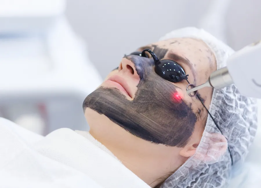 إزالة التصبغات